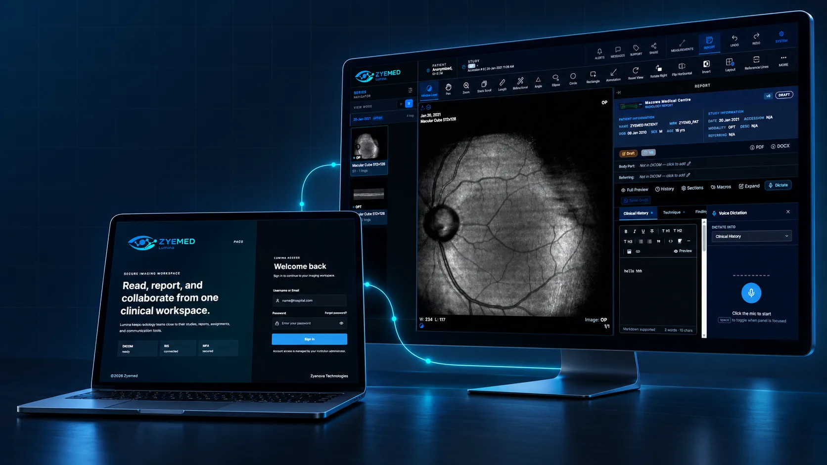 Zyemed Lumina clinical imaging workspace shown across connected devices